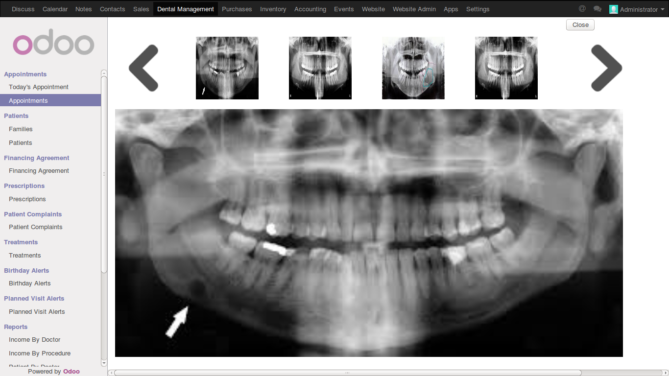 Screenshot of odoo dental clinic managment software